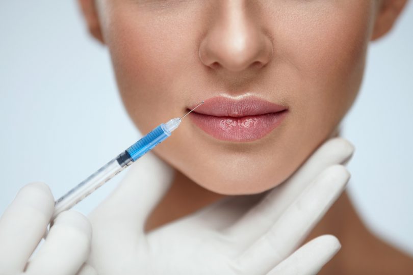 Rinoplastia nechirurgicală - remodelarea nasului prin injectarea cu acid hialuronic